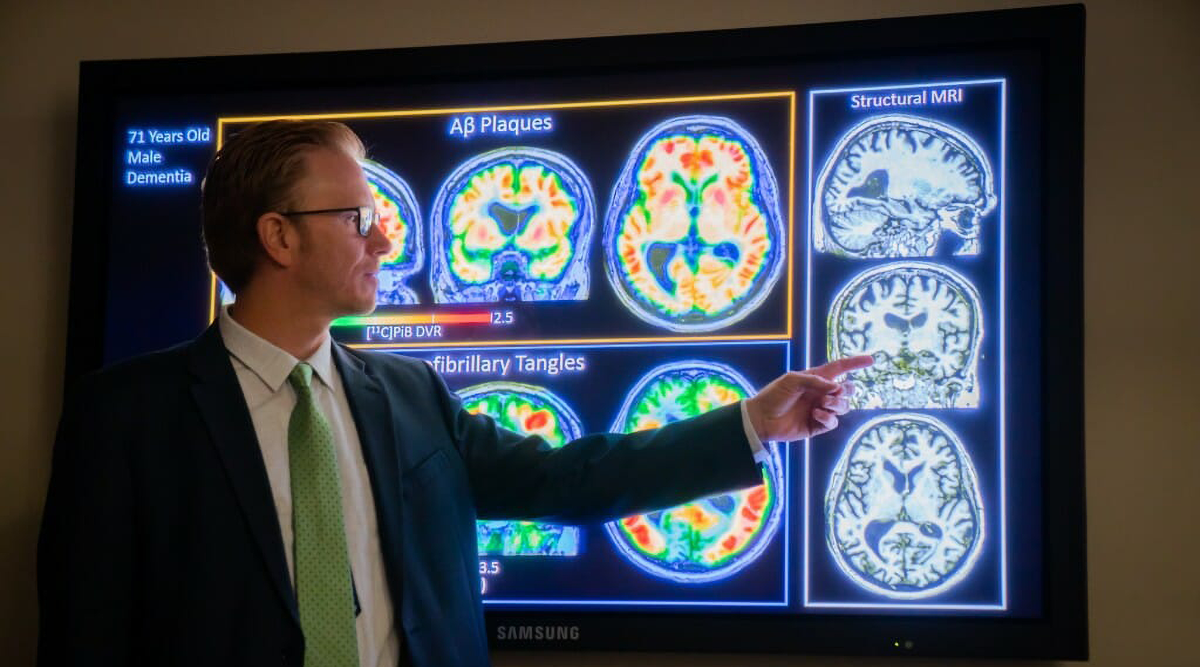 UW–Madison researcher Dr. Sterling Johnson points to some brain imaging.