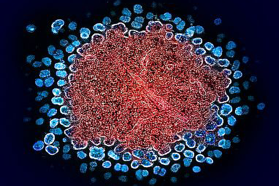 HIV particles